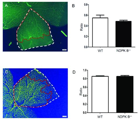 Ndpk B Deficiency Does Not Impair The Physiological Angiogenesis In The