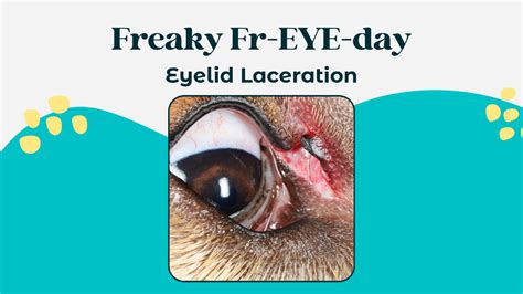 Eyelid Lacerations: What to Do?