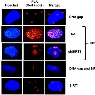 Positive Signals In Colocalization Experiment HK2 Cells Transfected