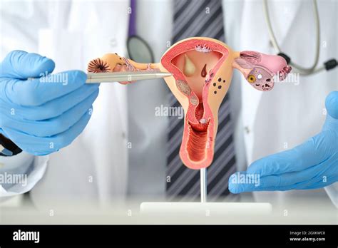 Man Gynecologist Showing Female Diseases With Pen On Plastic Artificial