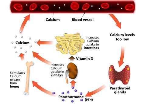 Vitamin D And Primary Hyperparathyroidism GrassrootsHealth