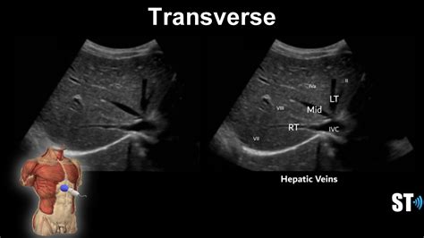 Liver Anatomy And Protocol Sonographic Tendencies Liver Anatomy