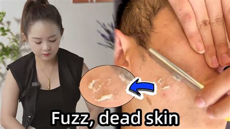 Asmr Rare Razor Remove Fuzz From Face And Shave Off Hair Relaxing