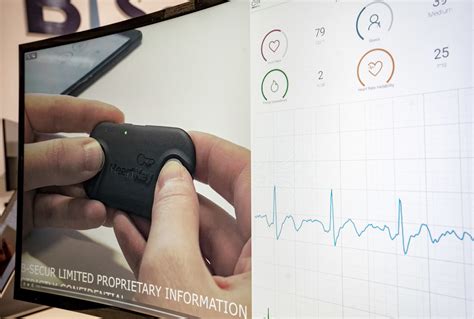 B Secur Receives Fda Clearance For Its Heartkey Ekg Ecg Technology