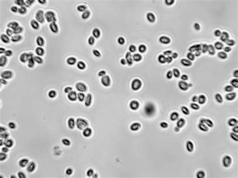 Saccharomyces Cerevisiae Viticulture And Enology