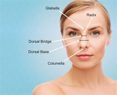 Nose Bridge Surgery In Dallas Tx Nasal Bridge Rhinoplasty