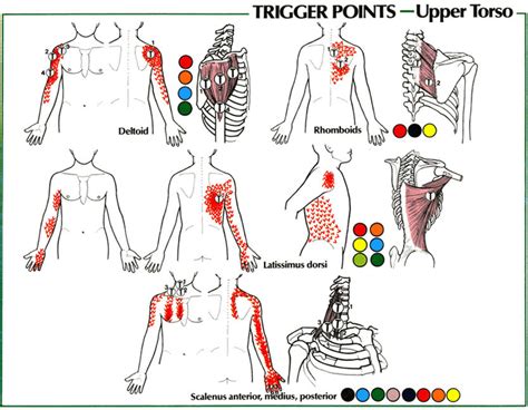 Cloward Sign And Cervical Referral Patterns Modern Manual Therapy Blog