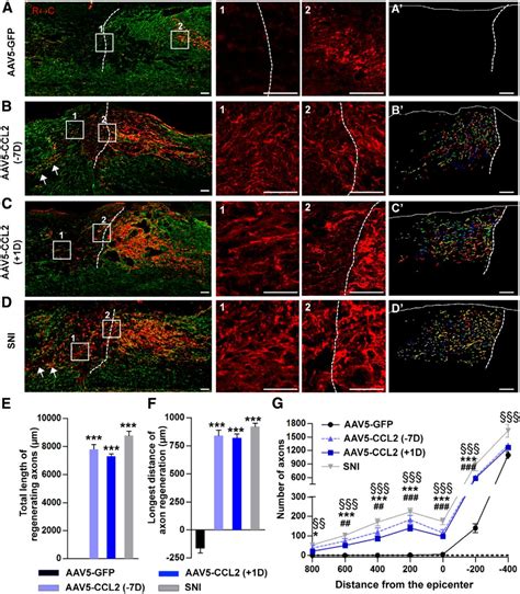 Ccl2 Mediates Neuronmacrophage Interactions To Drive Proregenerative