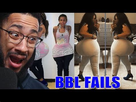 BBL Surgeries Gone Wrong - YouTube