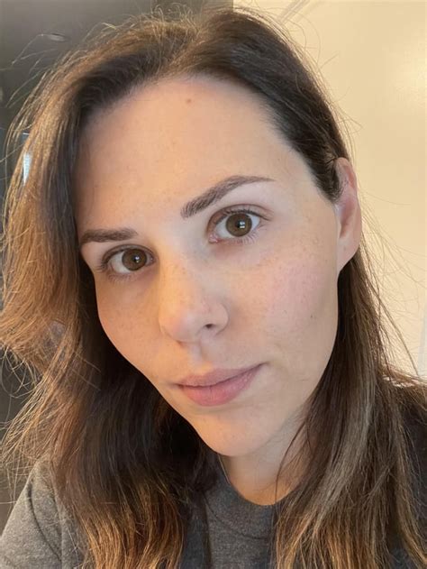 2 Weeks Healed Soooo Happy I Had Bald Spots In My Eyebrows Before