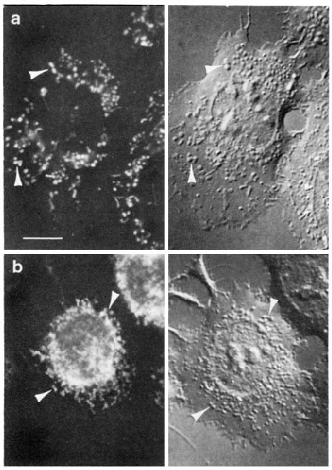 Fluorescence And Corresponding Nomarski Photomicrographs Comparing