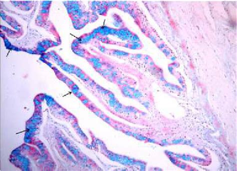 Intestine Nile Perch Showing The Mucins In The Goblet Cells Arrow AB