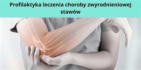 Jak Zatrzyma Chorob Zwyrodnieniow Staw W Profilaktyka