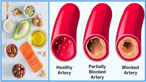 5 Ways To Increase Your Hdl Cholesterol Foods That Increase Hdl Youtube