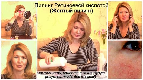 Ретиноевый пилинг (Желтый пилинг) - подробно. Готовим, наносим и ...