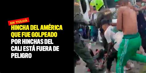 Hincha Del América Golpeado Por Hinchas Del Cali Está Fuera De Peligro