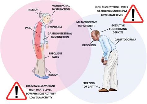 Parkinson Protocol By Jodi Knapp How To Treat Brain Deterioration