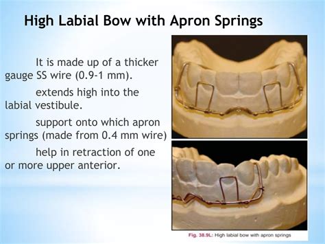 Labial Bows Ppt