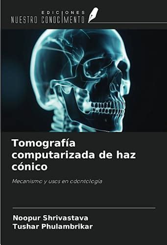 Tomografía computarizada de haz cónico Mecanismo y usos en odontología