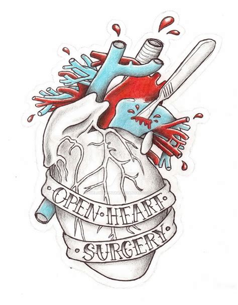 Open Heart Surgery by ZielonaPepitka on DeviantArt