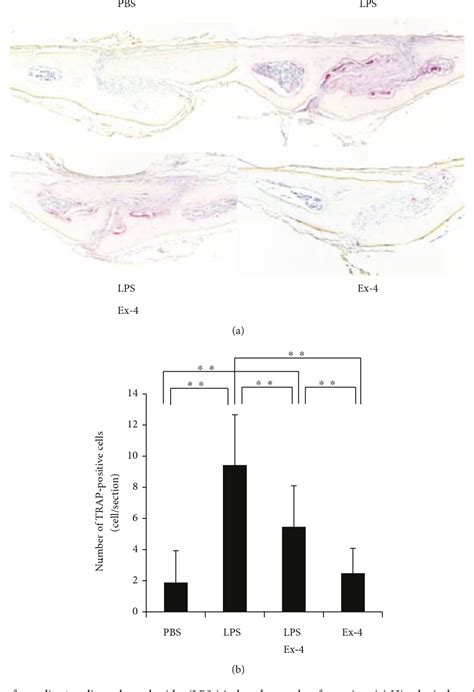 Figure 1 From The Glucagon Like Peptide 1 Receptor Agonist Exendin 4 Inhibits Lipopolysaccharide