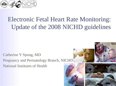 Ppt Electronic Fetal Heart Rate Monitoring Update Of The 2008 Nichd