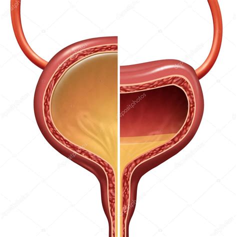 Bladder Normal And Overactive Condition Stock Photo Lightsource