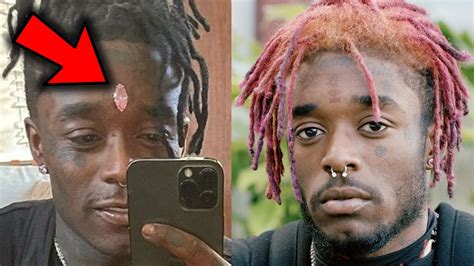 Lil Uzi Vert Diamond Removed - IRUBSS