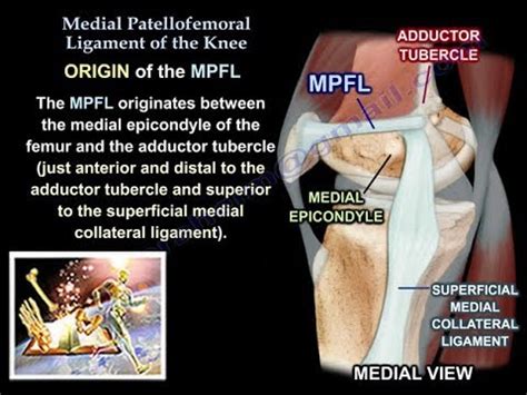 Medial Patellofemoral Ligament Anatomy