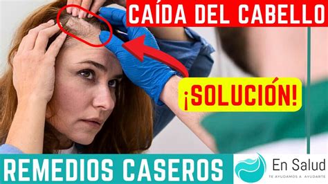 Caida Del Cabello Remedios Caseros Para La Caida Del Pelo Ensalud