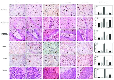 Photomicrograph Of The Immunohistochemical Staining Of Brain Tissue For