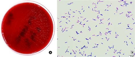 (A) Blood agar plate after a 24-hour incubation at 37°C, 5% CO2;... | Download Scientific Diagram