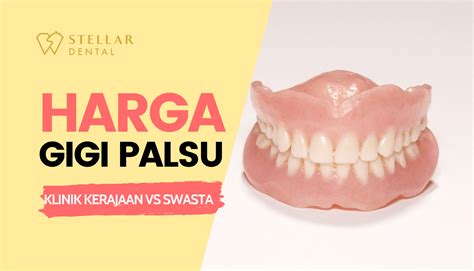 Crown Gigi Fungsi Jenis Harga Di Klinik Swasta Stellar Dental