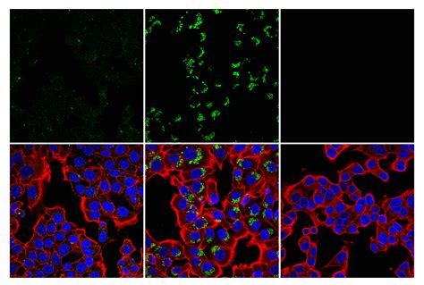 LC3B (E5Q2K) Mouse mAb (Alexa Fluor® 488 Conjugate) | Cell Signaling ...