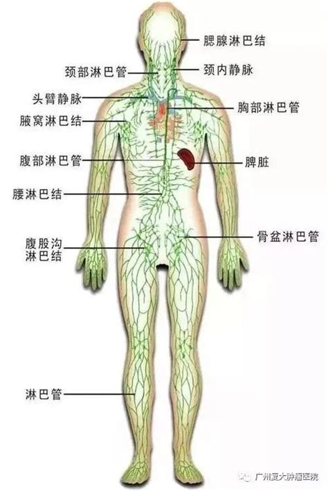 淋巴结肿大，疼比不疼强！这些部位肿大更危险广州抗癌协会