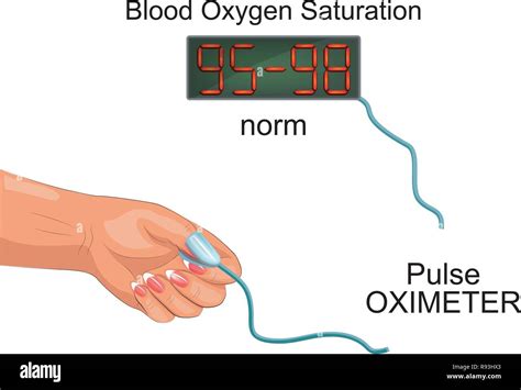 Pulse Oximetry Stock Photos & Pulse Oximetry Stock Images - Alamy