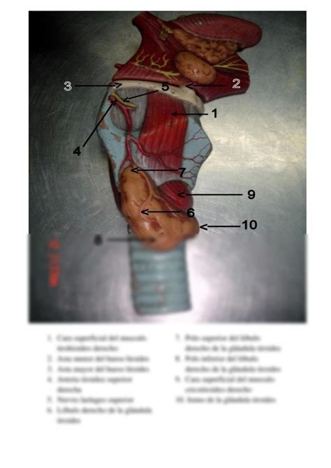 SOLUTION Imagenes Rotuladas 1er Parcial Anatomia Studypool