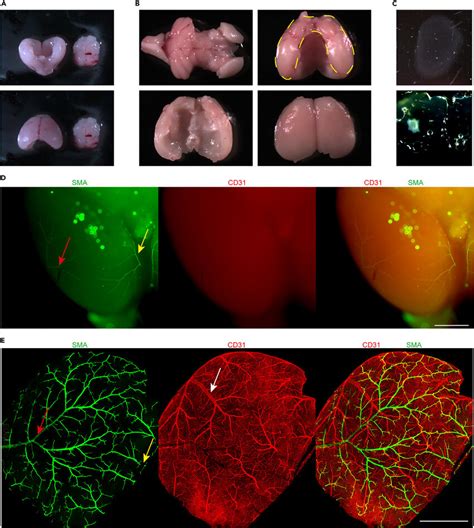 Cortex Dissection Flattening And Vibratome Sectioning A Detached P4