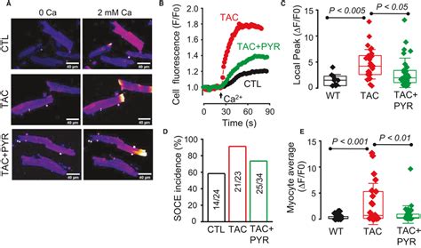 Pyridostigmine Reduces STIM1dependent Storeoperated Ca Entry SOCE