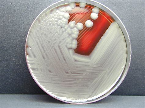 Bacillus Cereus Agar