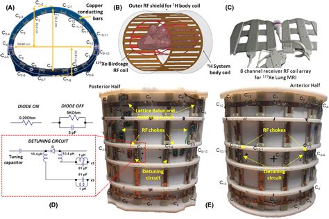 An Asymmetrical Wholebody Birdcage Rf Coil Without Rf Shield For