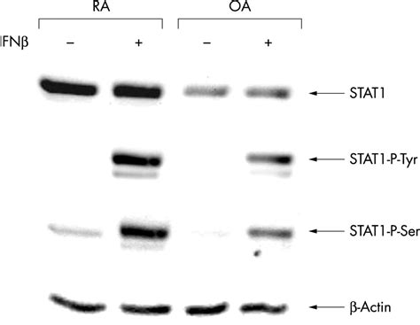 Activation of the STAT1 pathway in rheumatoid arthritis | Annals of the ...