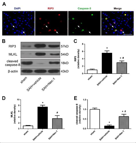 Necrostatin Down Regulated Rip Mlkl Signaling Pathway After Sah