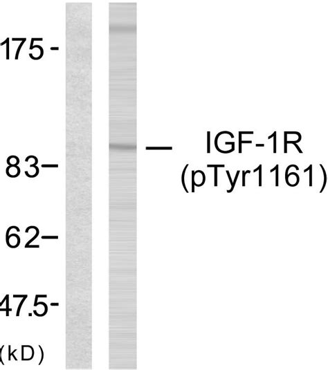 Anti Igf R Igf Receptor Antibody Rabbit Anti Human Polyclonal Lsbio