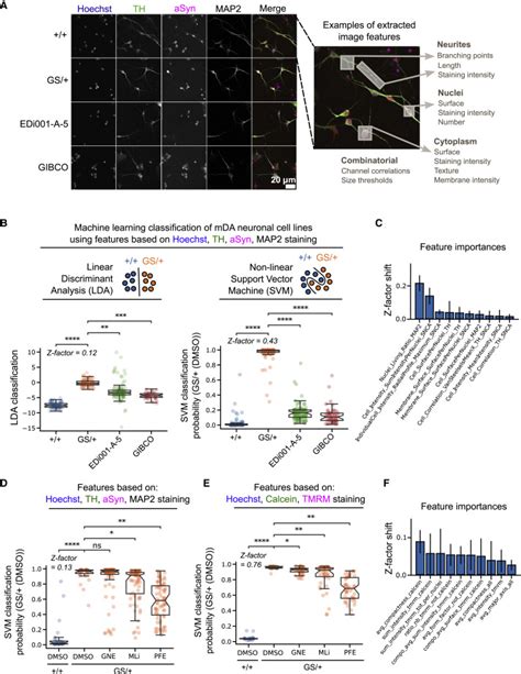 High Content Phenotyping Of Parkinson S Disease Patient Stem Cell