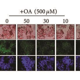 Effect Of ZA M On OA Induced Intracellular Lipid Accumulation In HepG2