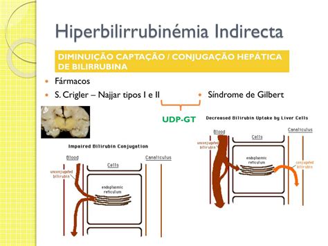 PPT Diagnóstico Diferencial Icterícias PowerPoint Presentation free