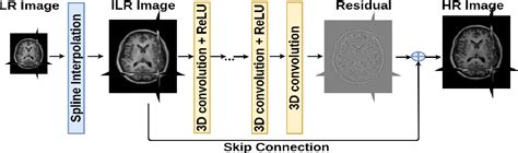 Figure 1 From Multiscale Brain Mri Super Resolution Using Deep 3d Convolutional Networks