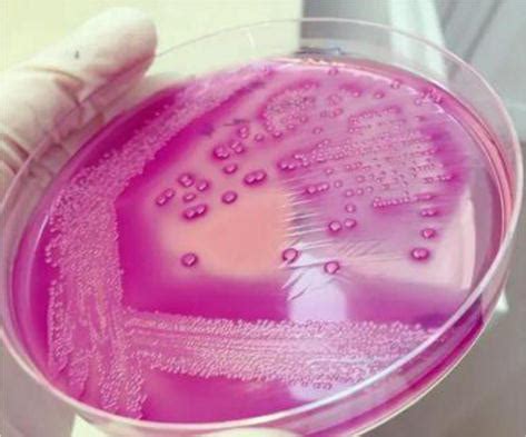 Escherichia Coli An Overview Of Main Characteristics IntechOpen