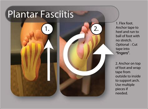 Kinesiology Tape For Plantar Fasciitis Plant Ideas